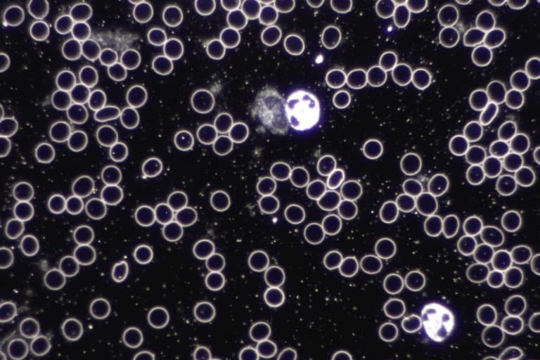 Vitalblut Untersuchung Dunkelfeldmikroskop Rosenheim